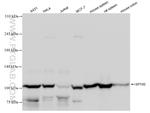 SP100 Antibody in Western Blot (WB)