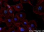 SP100 Antibody in Immunocytochemistry (ICC/IF)