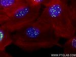 SP100 Antibody in Immunocytochemistry (ICC/IF)