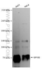 SP100 Antibody in Western Blot (WB)