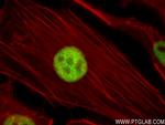 FOXF1 Antibody in Immunocytochemistry (ICC/IF)