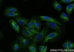 NFKB2, p100 Antibody in Immunocytochemistry (ICC/IF)