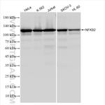 NFKB2, p100 Antibody in Western Blot (WB)