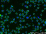 CSF2RA/CD116 Antibody in Immunocytochemistry (ICC/IF)