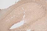 PEG3 Antibody in Immunohistochemistry (Paraffin) (IHC (P))
