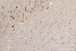 PEG3 Antibody in Immunohistochemistry (Paraffin) (IHC (P))