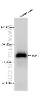 TGM1 Antibody in Western Blot (WB)