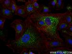ACSF2 Antibody in Immunocytochemistry (ICC/IF)