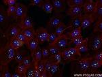 UTP18 Antibody in Immunocytochemistry (ICC/IF)