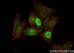 PRC1 Antibody in Immunocytochemistry (ICC/IF)