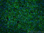 APOB Antibody in Immunohistochemistry (PFA fixed) (IHC (PFA))