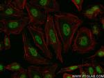 RREB1 Antibody in Immunocytochemistry (ICC/IF)