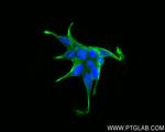 CTNNAL1 Antibody in Immunocytochemistry (ICC/IF)