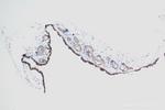 DSG1 Antibody in Immunohistochemistry (Paraffin) (IHC (P))
