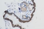 DSG1 Antibody in Immunohistochemistry (Paraffin) (IHC (P))