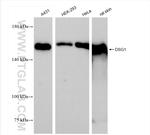 DSG1 Antibody in Western Blot (WB)