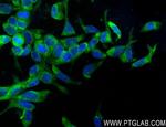 KLK3/PSA Antibody in Immunocytochemistry (ICC/IF)