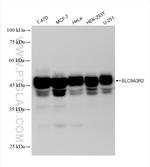 SLC9A3R2 Antibody in Western Blot (WB)