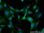 LEP Antibody in Immunocytochemistry (ICC/IF)