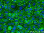 EPCAM/CD326 Antibody in Immunocytochemistry (ICC/IF)