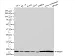 FKBP2 Antibody in Western Blot (WB)