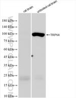 TRPV4 Antibody in Western Blot (WB)