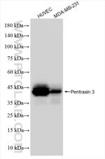 Pentraxin 3 Antibody in Western Blot (WB)
