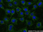 MYH2 Antibody in Immunocytochemistry (ICC/IF)