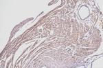 MYH2 Antibody in Immunohistochemistry (Paraffin) (IHC (P))