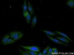 Complement factor B Antibody in Immunocytochemistry (ICC/IF)