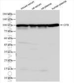 Complement factor B Antibody in Western Blot (WB)