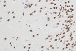 RBM10 Antibody in Immunohistochemistry (Paraffin) (IHC (P))