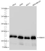 RBM10 Antibody in Western Blot (WB)