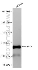 RBM10 Antibody in Western Blot (WB)