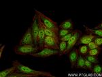 GLI2 Antibody in Immunocytochemistry (ICC/IF)
