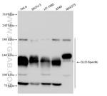 GLI2 Antibody in Western Blot (WB)