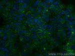 CD9 Antibody in Immunocytochemistry (ICC/IF)
