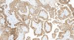 CD9 Antibody in Immunohistochemistry (Paraffin) (IHC (P))