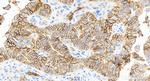 CD9 Antibody in Immunohistochemistry (Paraffin) (IHC (P))