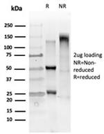 GTF2IRD2 Antibody in SDS-PAGE (SDS-PAGE)