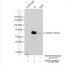 SNTB1 Antibody in Immunoprecipitation (IP)