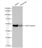 SNTB1 Antibody in Western Blot (WB)