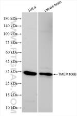 TMEM106B Antibody in Western Blot (WB)
