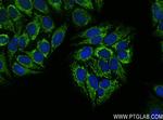 NSUN4 Antibody in Immunocytochemistry (ICC/IF)