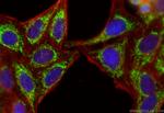 NSUN4 Antibody in Immunocytochemistry (ICC/IF)