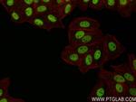 ZNF217 Antibody in Immunocytochemistry (ICC/IF)