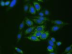 CPS1 Antibody in Immunocytochemistry (ICC/IF)