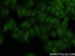 Beta TrCP Antibody in Immunocytochemistry (ICC/IF)