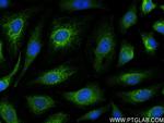 POTEA Antibody in Immunocytochemistry (ICC/IF)