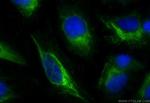 POTEA Antibody in Immunocytochemistry (ICC/IF)